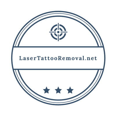 Laser Tattoo Removal Website For Sale